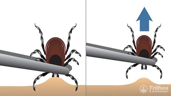 proper-tick-removal.jpg